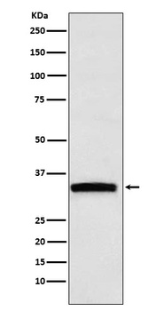 Anti-GDF15 Rabbit Monoclonal Antibody