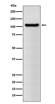 BRD2 Rabbit Monoclonal Antibody