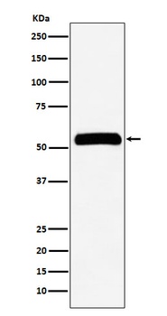 IMPDH2 Rabbit Monoclonal Antibody