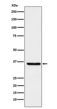 Anti-GSTO1 Rabbit Monoclonal Antibody