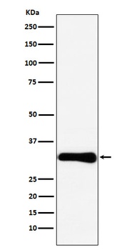 Bcl10 Rabbit Monoclonal Antibody