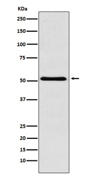 Anti-BAF57/SMARCE1 Rabbit Monoclonal Antibody