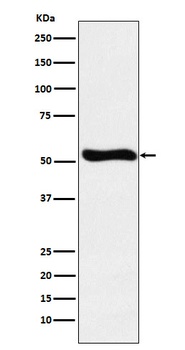 Lumican Rabbit Monoclonal Antibody