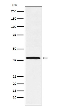 Fbx32 Rabbit Monoclonal Antibody