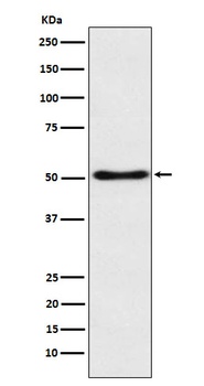 Anti-SFRP4 Rabbit Monoclonal Antibody
