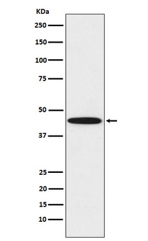 DDB2 Rabbit Monoclonal Antibody