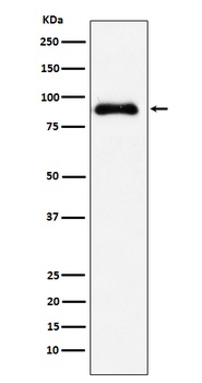 Anti-SATB2 Rabbit Monoclonal Antibody