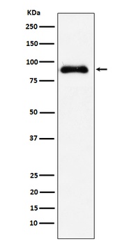 SATB2 Rabbit Monoclonal Antibody