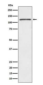 Anti-FYB Rabbit Monoclonal Antibody