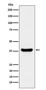 Protein Phosphatase 1 beta Rabbit Monoclonal Antibody