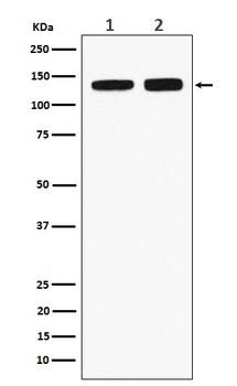 Anti-RNF40 Rabbit Monoclonal Antibody