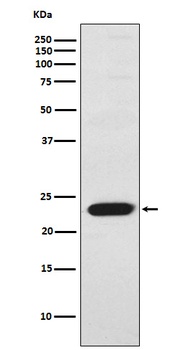 TNNI2 Rabbit Monoclonal Antibody