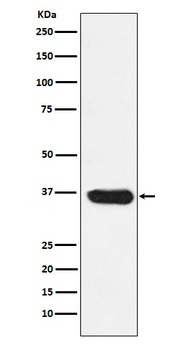 LDHA Rabbit Monoclonal Antibody