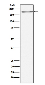 Anti-LRP6 Rabbit Monoclonal Antibody