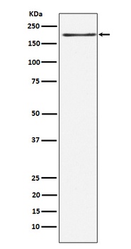 LRP6 Rabbit Monoclonal Antibody