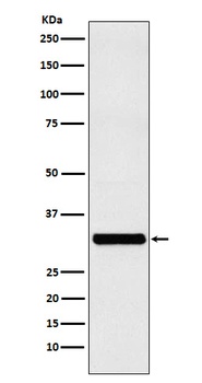 Anti-RAB27A Rabbit Monoclonal Antibody