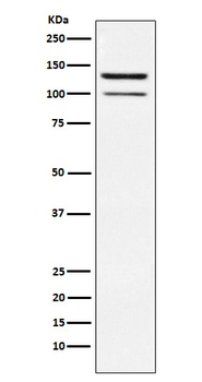 Anti-HIPK2 Rabbit Monoclonal Antibody