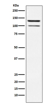 HIPK2 Rabbit Monoclonal Antibody