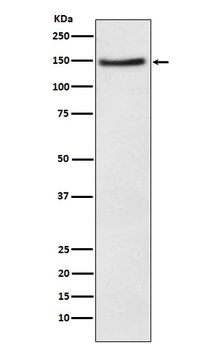 Anti-NPC1L1 Rabbit Monoclonal Antibody