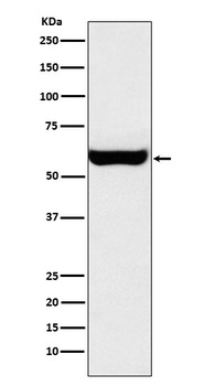 Monoamine Oxidase A Rabbit Monoclonal Antibody