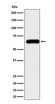 SQSTM1 / p62 Rabbit Monoclonal Antibody