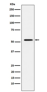 Anti-MMP1 Rabbit Monoclonal Antibody