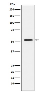 MMP1 Rabbit Monoclonal Antibody