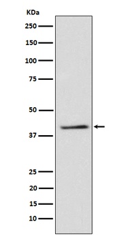 Anti-TRIB3 Rabbit Monoclonal Antibody