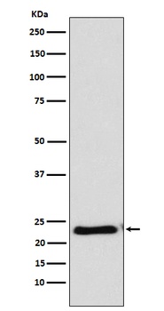 Anti-RAIDD Rabbit Monoclonal Antibody