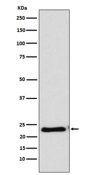 RAIDD Rabbit Monoclonal Antibody