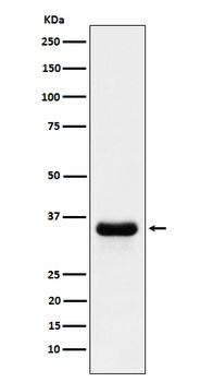 Anti-PSMD14 Rabbit Monoclonal Antibody