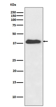 Anti-XLF Rabbit Monoclonal Antibody