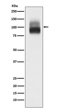 TrkB Rabbit Monoclonal Antibody