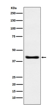Anti-SPOP Rabbit Monoclonal Antibody