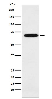 Anti-IKZF3 Rabbit Monoclonal Antibody