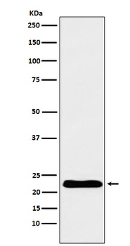 Anti-TNNI1 Rabbit Monoclonal Antibody