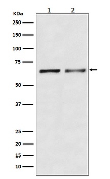 Activin Receptor Type IIB/ACVR2B Rabbit Monoclonal Antibody