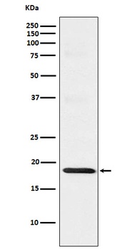 TOMM22/TOM22 Rabbit Monoclonal Antibody