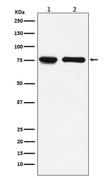IL7R alpha/CD127 Rabbit Monoclonal Antibody