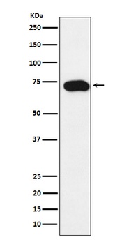 Anti-SLC22A1 Rabbit Monoclonal Antibody