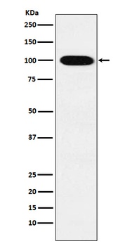 Anti-VPS18 Rabbit Monoclonal Antibody