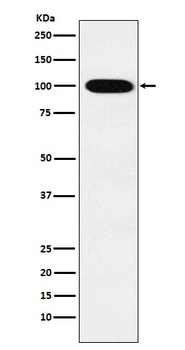 VPS18 Rabbit Monoclonal Antibody