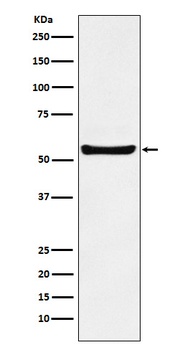 PAR2 Rabbit Monoclonal Antibody