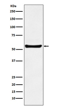 Anti-PAR2 Rabbit Monoclonal Antibody
