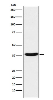 Anti-MT-ND1 Rabbit Monoclonal Antibody