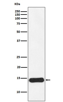 Anti-CRABP1 Rabbit Monoclonal Antibody