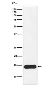 CRABP1 Rabbit Monoclonal Antibody