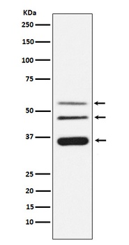 Legumain Rabbit Monoclonal Antibody