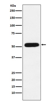 Anti-CBX4 Rabbit Monoclonal Antibody