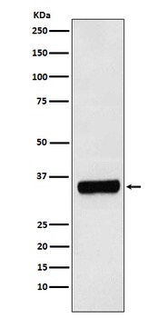Anti-PRKRA Rabbit Monoclonal Antibody